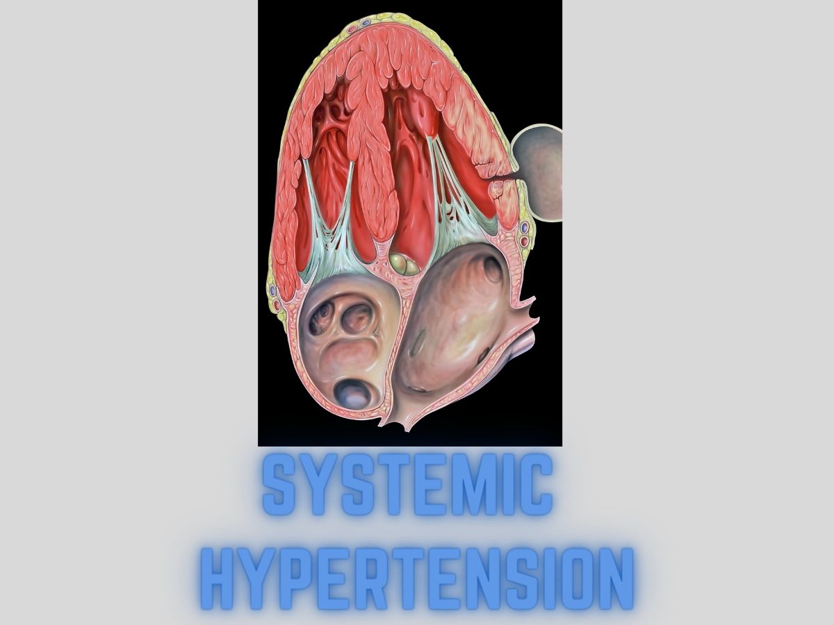 Systemic Hypertension